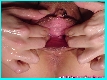 Fisting Big Pussy Lips